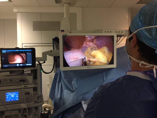 Meilleure opération pour la prise en charge des rectocolites hémorragiques (RCH) à Paris