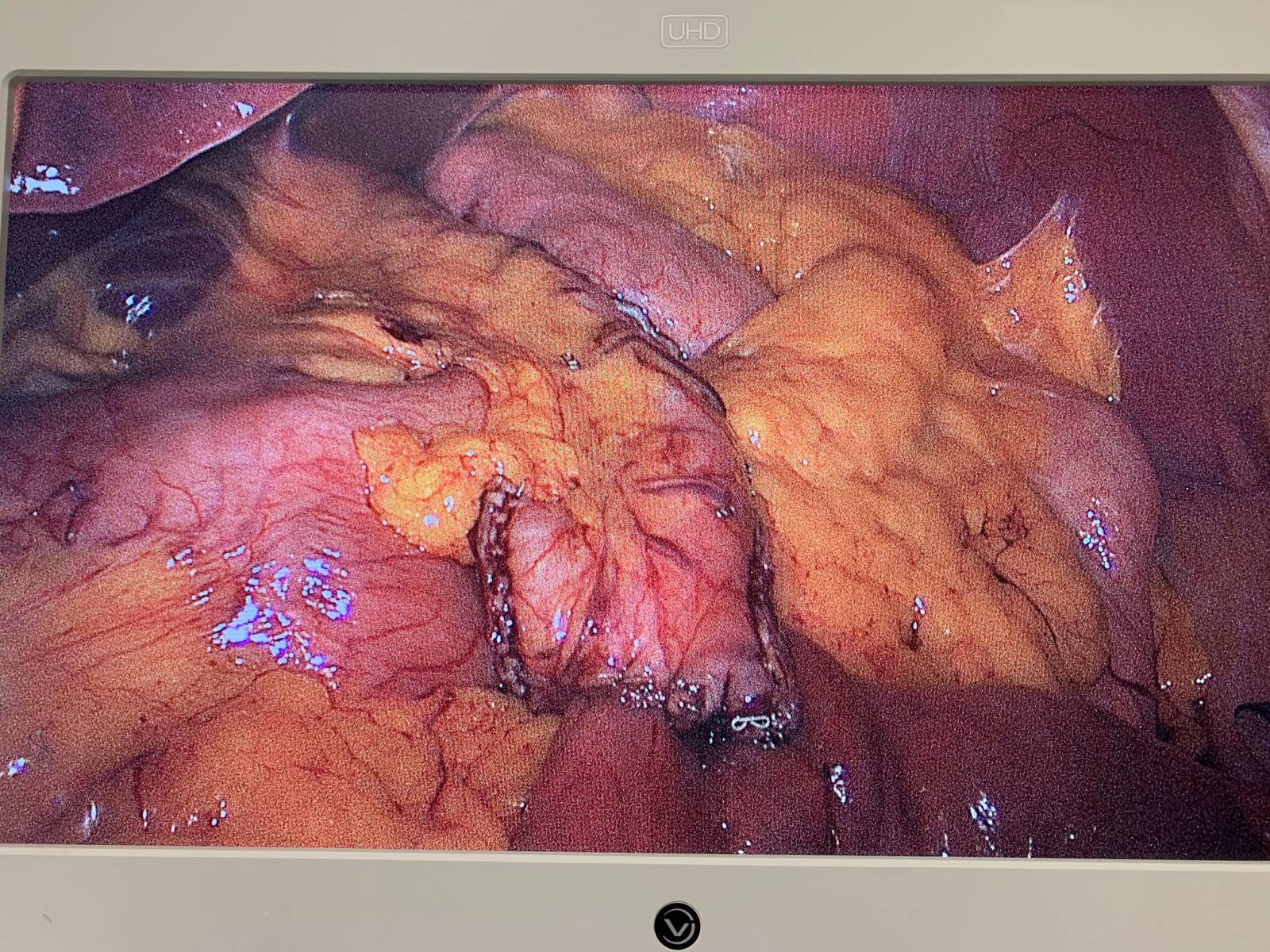 Trouver un chirurgien spécialiste de l'obésité à Paris: le groupe MUST