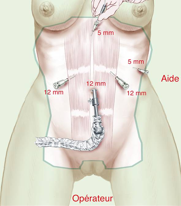 Centre Expert chirurgie bariatrique MUST à Paris