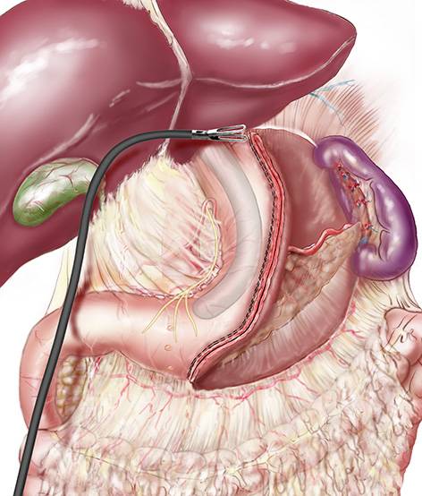 Prix Sleeve à Paris